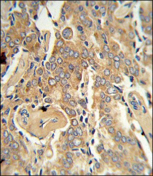 ANTI-VEGFC antibody produced in rabbit IgG fraction of antiserum, buffered aqueous solution