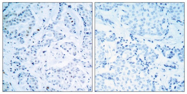 Anti-Estrogen Receptor-&#945; antibody produced in rabbit affinity isolated antibody