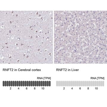 Anti-RNFT2 antibody produced in rabbit Prestige Antibodies&#174; Powered by Atlas Antibodies, affinity isolated antibody, buffered aqueous glycerol solution