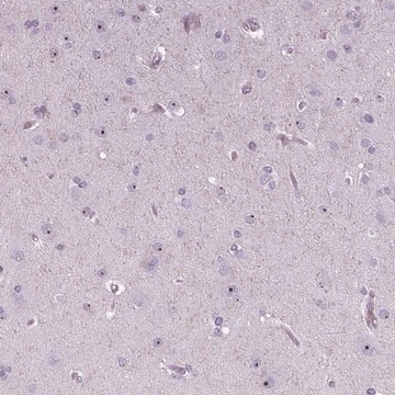 Anti-NOLC1 antibody produced in rabbit Prestige Antibodies&#174; Powered by Atlas Antibodies, affinity isolated antibody, buffered aqueous glycerol solution