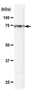 Anti-HRD1 Antibody from rabbit, purified by affinity chromatography