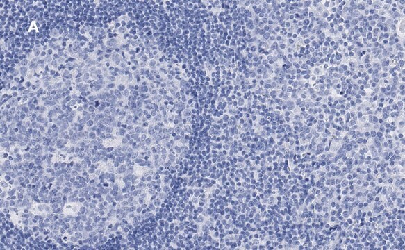 抗カルネキシン抗体 クローン10N19 ZooMAb&#174; ウサギ・モノクローナル recombinant, expressed in HEK 293 cells