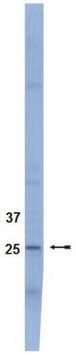 Anti-SOCS3 Antibody, clone 1B2 clone 1B2, Upstate&#174;, from mouse