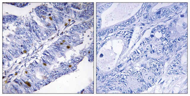 Anti-phospho-Nuclear Receptor NR4A1 (pSer351) antibody produced in rabbit affinity isolated antibody