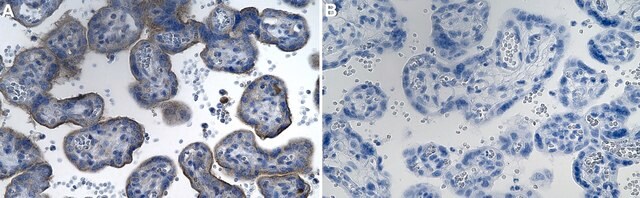 Anti-Podoplanin Antibody, clone 3N7 ZooMAb&#174; Rabbit Monoclonal recombinant, expressed in HEK 293 cells