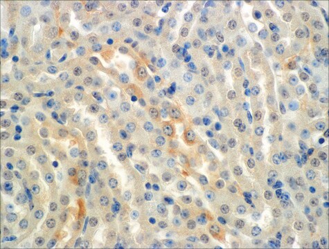 Monoclonal Anti-ENaC alpha antibody produced in mouse clone 2G4