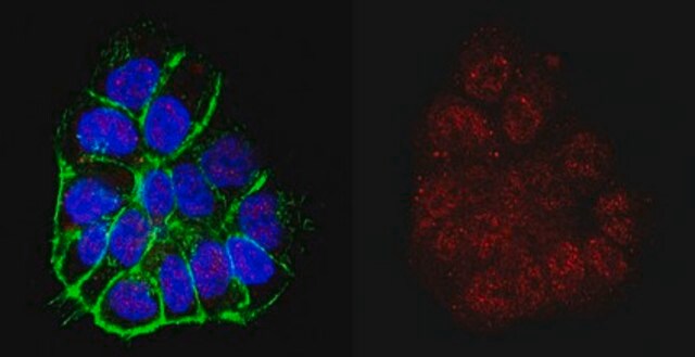 Anticuerpo anti-TERT from rabbit, purified by affinity chromatography