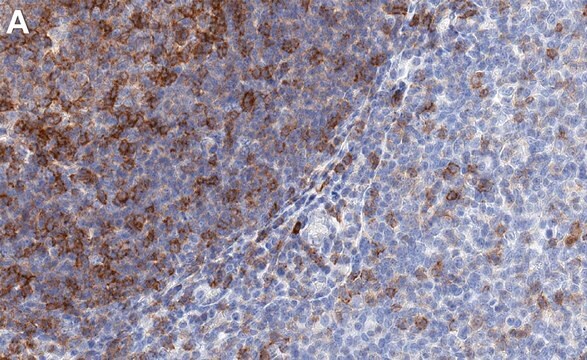 Anti-Fyn Antibody, clone 2F15 ZooMAb&#174; Rabbit Monoclonal recombinant, expressed in HEK 293 cells