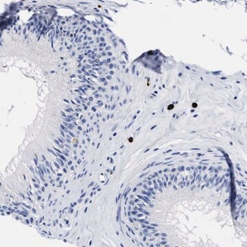 Anti-CER1 antibody produced in rabbit Prestige Antibodies&#174; Powered by Atlas Antibodies, affinity isolated antibody, buffered aqueous glycerol solution