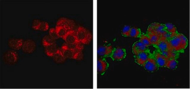 Anti-Vesicular Glutamate Transporter 3 (VGLUT3) 抗体 serum, from guinea pig