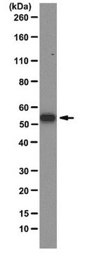 Przeciwciało anty-G3BP1, klon 14E5-G9 clone 14E5-G9, from mouse