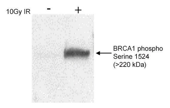 Rabbit anti-Phospho BRCA1 (S1524) Antibody, Affinity Purified