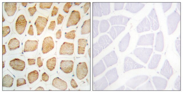 Anti-Actinin &#945; antibody produced in rabbit affinity isolated antibody