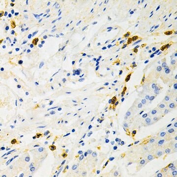 Anti-NF-kB p65 antibody produced in rabbit