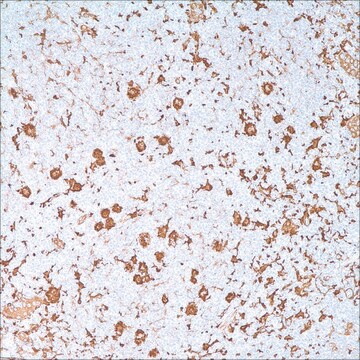 Fascin (55k-2) Mouse Monoclonal Antibody