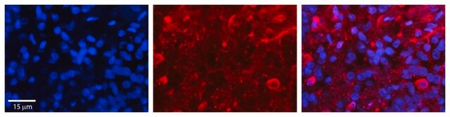 Anti-SLC27A6 antibody produced in rabbit affinity isolated antibody