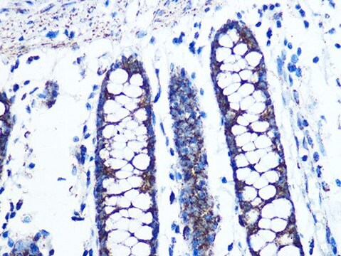 Anti-UQCRC2 antibody produced in rabbit