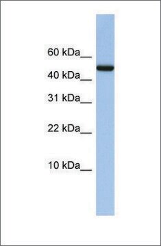 Anti-ABAT antibody produced in rabbit affinity isolated antibody