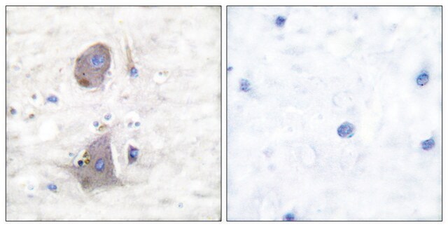 Anti-GLUT1 antibody produced in rabbit affinity isolated antibody