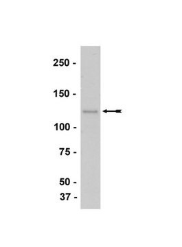 Anti-M-Cadherin-Antikörper, Klon&nbsp;12G4 clone 12G4, Upstate&#174;, from mouse