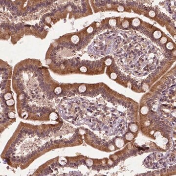 Anti-TMX2 antibody produced in rabbit Prestige Antibodies&#174; Powered by Atlas Antibodies, affinity isolated antibody, buffered aqueous glycerol solution