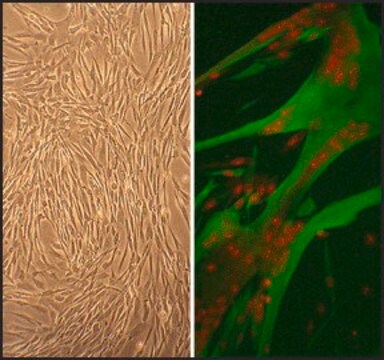 Human Skeletal Muscle Cells: HSkMC, adult