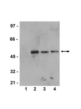 Przeciwciało anty-fosfo-MEK1 (Ser218/222)/MEK2 (Ser222/226), królicze monoklonalne Upstate&#174;, from rabbit