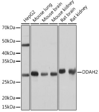 Anti-DDAH2 Antibody, clone 5M4Y4, Rabbit Monoclonal