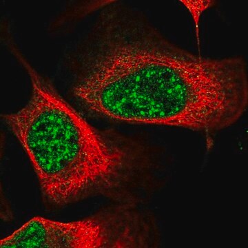 Anti-EEPD1 antibody produced in rabbit Prestige Antibodies&#174; Powered by Atlas Antibodies, affinity isolated antibody