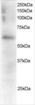 抗FGR抗体 ヤギ宿主抗体 affinity isolated antibody, buffered aqueous solution