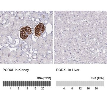 抗PODXL抗体 マウス宿主抗体 Prestige Antibodies&#174; Powered by Atlas Antibodies, clone CL0308, purified immunoglobulin, buffered aqueous glycerol solution