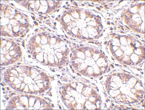 Anti-STEAP2 antibody produced in rabbit affinity isolated antibody, buffered aqueous solution