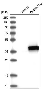 Anti-RABGGTB antibody produced in rabbit Prestige Antibodies&#174; Powered by Atlas Antibodies, affinity isolated antibody, buffered aqueous glycerol solution, Ab2