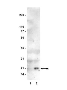 Ras-Assay-Reagens (Raf-1 RBD, Agarose)