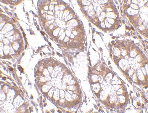 抗PTK7抗体 ウサギ宿主抗体 affinity isolated antibody, buffered aqueous solution