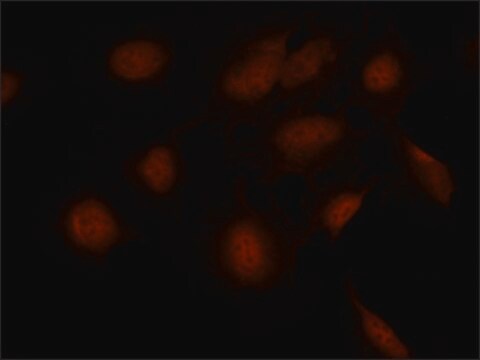 Anti-SMAD7 (N-terminal) antibody produced in rabbit ~1.0&#160;mg/mL, affinity isolated antibody, suitable for western blot: 2&#160;&#956;g/mL