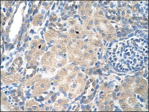 Anti-SLC13A3 (AB2) antibody produced in rabbit IgG fraction of antiserum