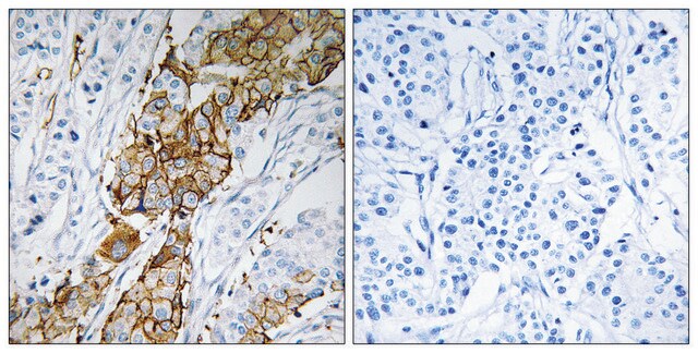 Anti-USP32 antibody produced in rabbit affinity isolated antibody