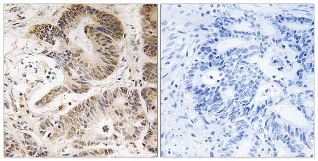 Anti-PIK3R5 antibody produced in rabbit affinity isolated antibody