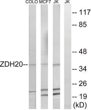 Anti-ZDHHC20 antibody produced in rabbit affinity isolated antibody