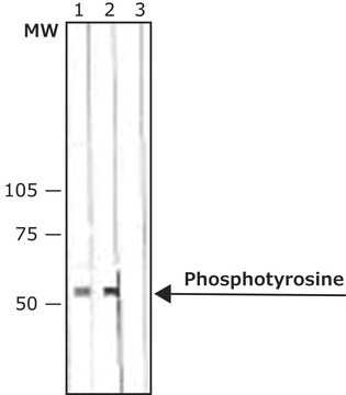 抗 磷酸酪氨酸抗体，小鼠单克隆 clone PT-66, purified from hybridoma cell culture