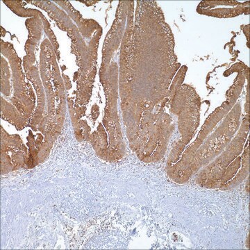 CEA Rabbit Polyclonal Antibody