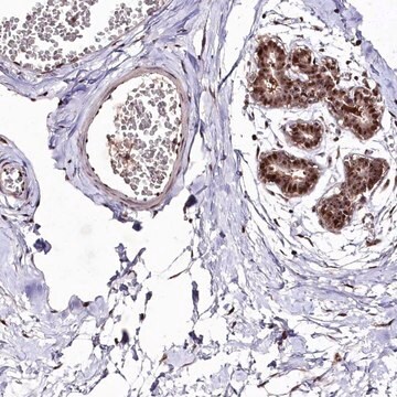 抗DMP1抗体 ウサギ宿主抗体 Prestige Antibodies&#174; Powered by Atlas Antibodies, affinity isolated antibody, buffered aqueous glycerol solution