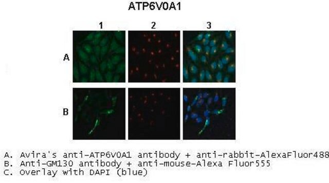 Anti-ATP6V0A1, (C-terminal) antibody produced in rabbit affinity isolated antibody