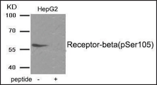 Anti-phospho-Estrogen Receptor-&#946; (pSer105) antibody produced in rabbit affinity isolated antibody