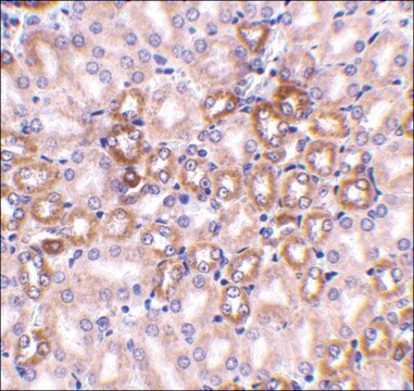 抗 Nephrin 兔抗 affinity isolated antibody, buffered aqueous solution