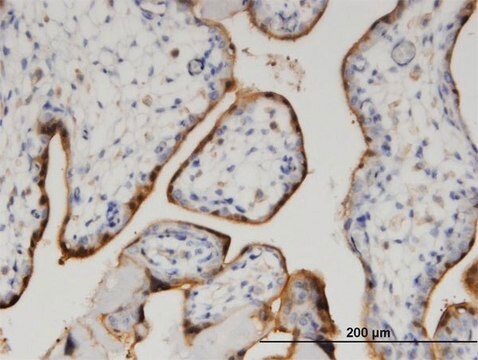 Monoclonal Anti-CLIC5 antibody produced in mouse clone 1E6, purified immunoglobulin, buffered aqueous solution