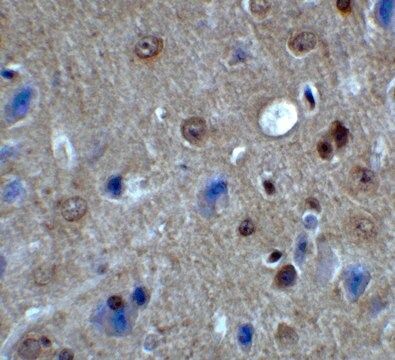 Anti-PACS1 antibody produced in rabbit affinity isolated antibody