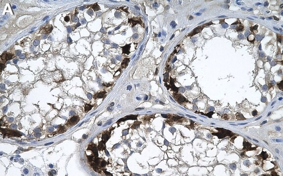 Anti-MGEA5/OGA Antibody, clone 1B3 ZooMAb&#174; Rabbit Monoclonal recombinant, expressed in HEK 293 cells