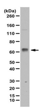 Przeciwciało anty-fosfo NFkB p65 (Ser547) from rabbit, purified by affinity chromatography